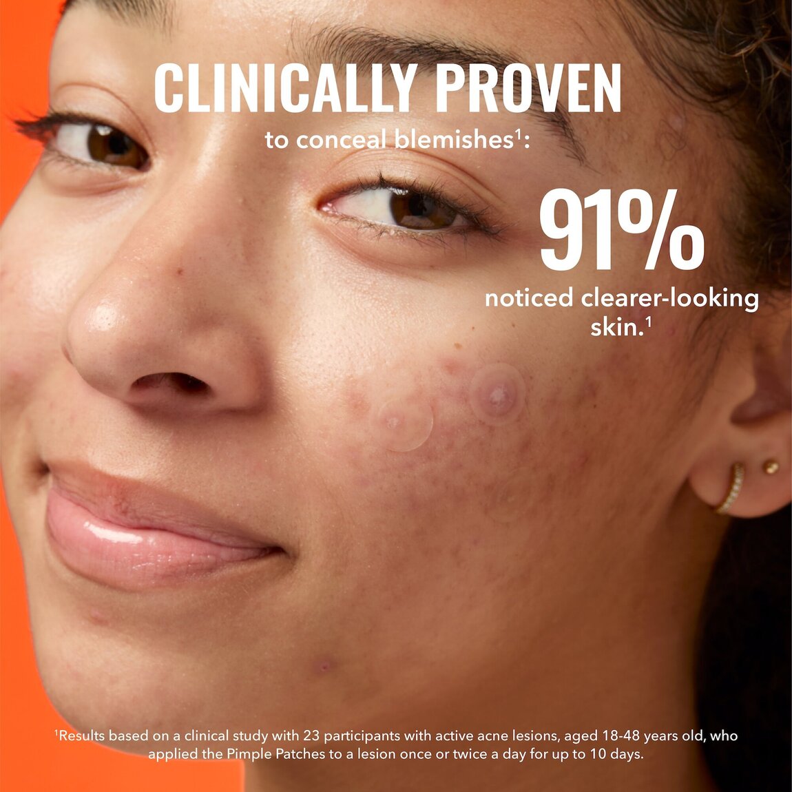pimple-patches-d4 zb_p.jpg