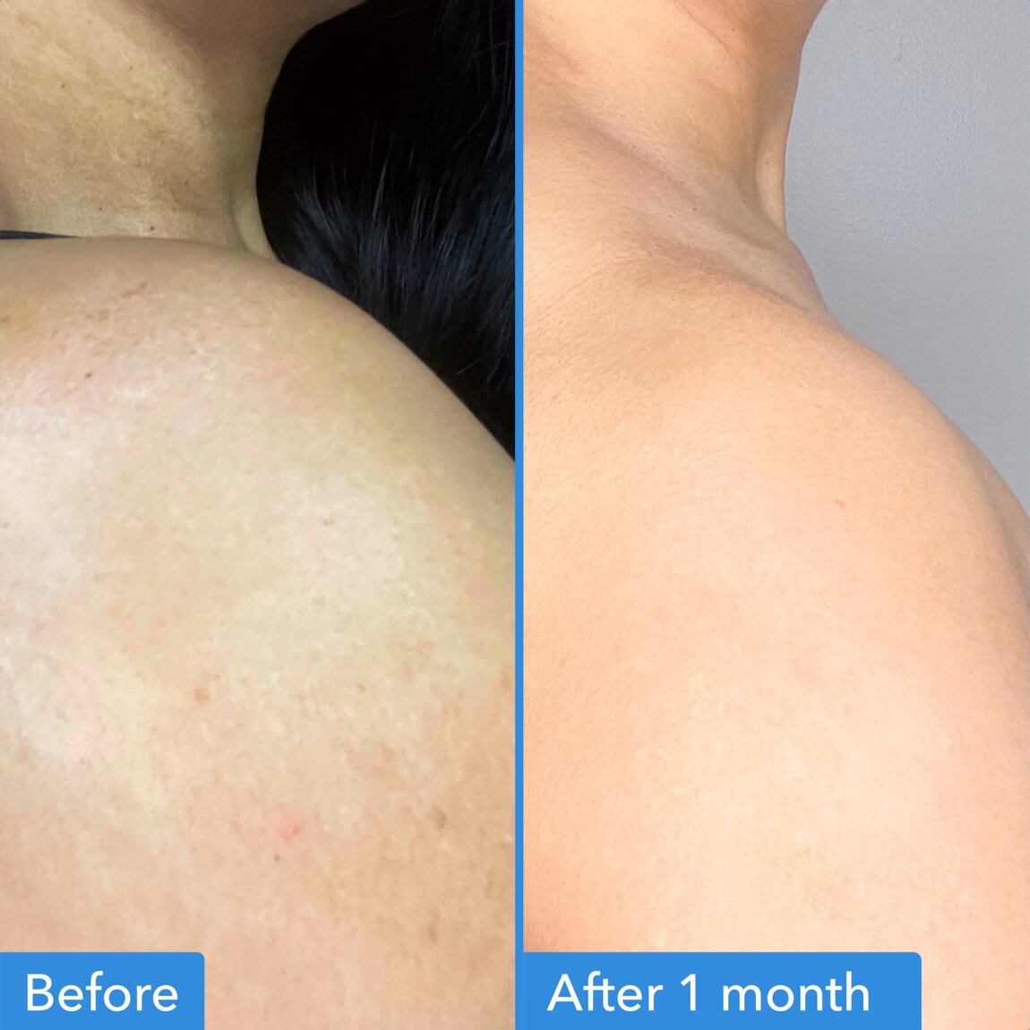 discoloration-correcting-body-treatment-m2 zb_p.jpg
